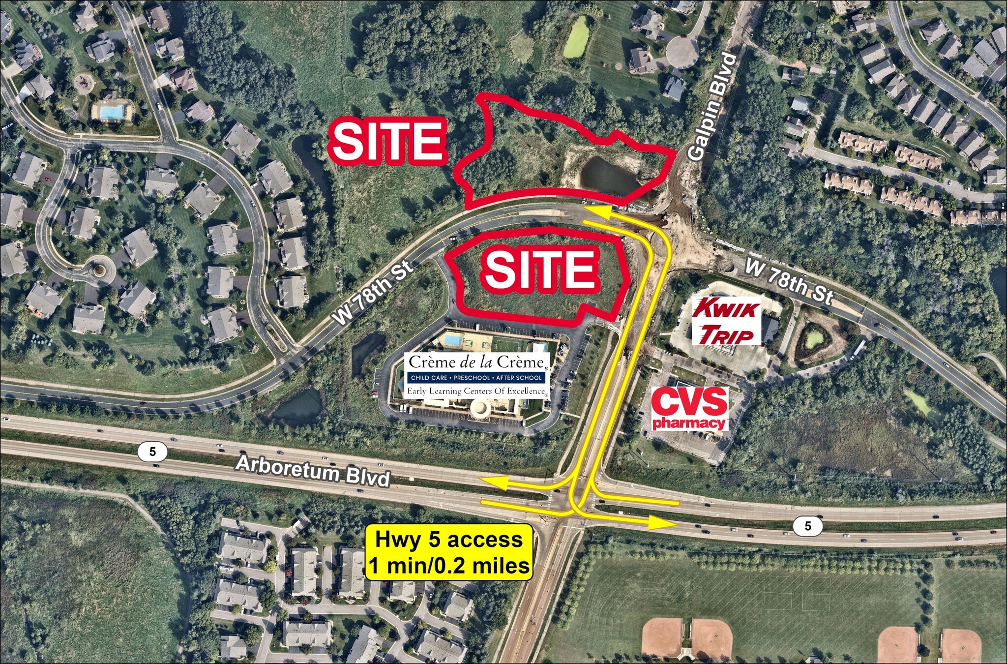 7750 Galpin Blvd, Chanhassen, MN for sale Building Photo- Image 1 of 2